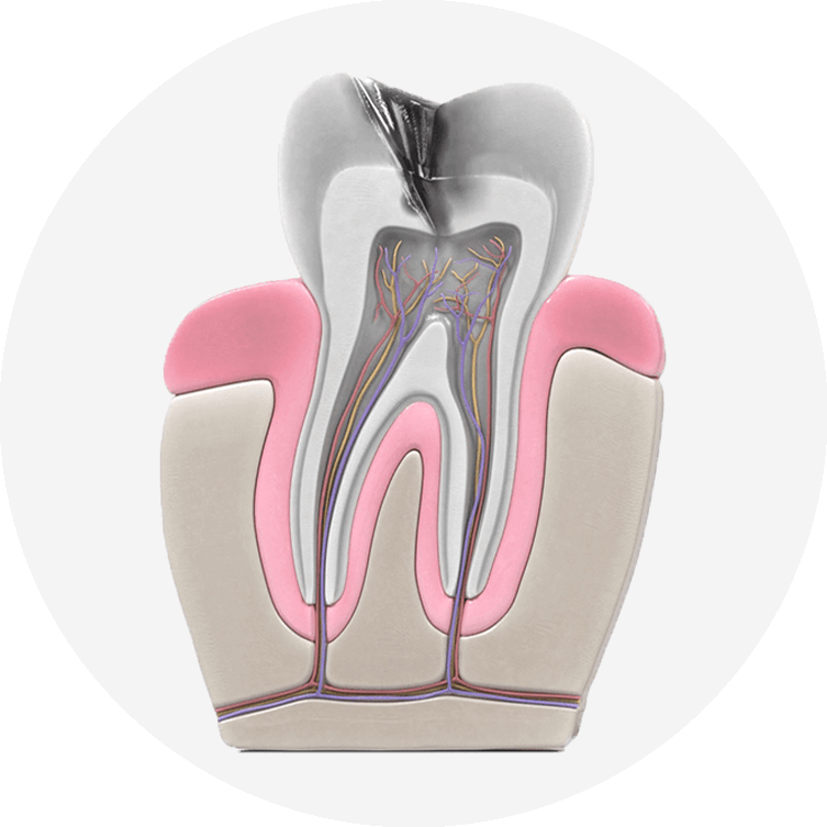 infected tooth