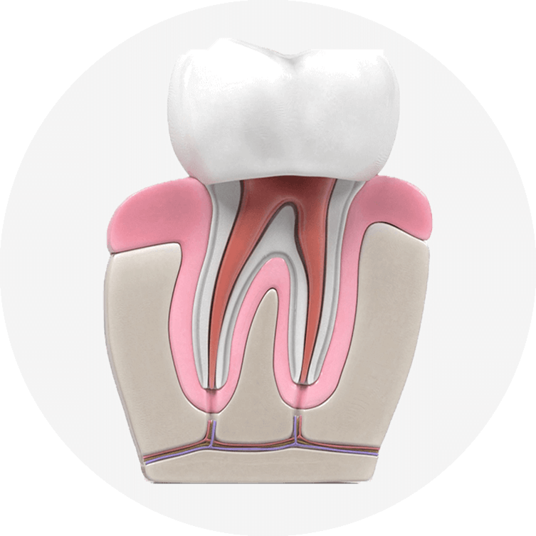 crown attached to root canal