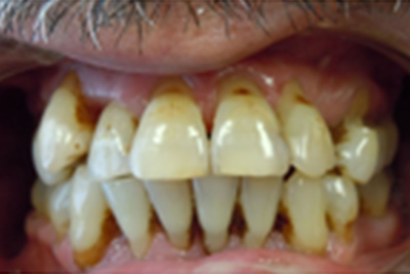 before smile makeover