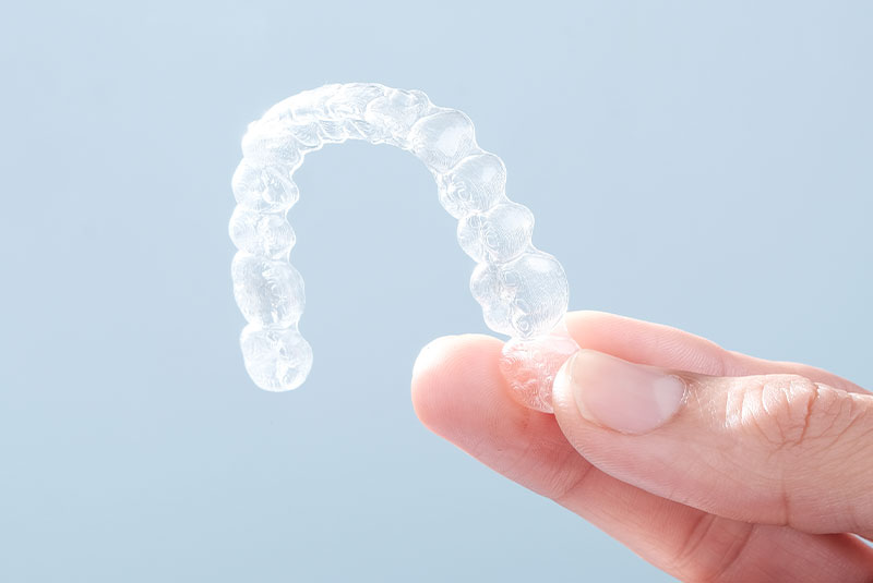 clear aligners