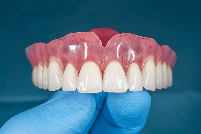 complete dentures