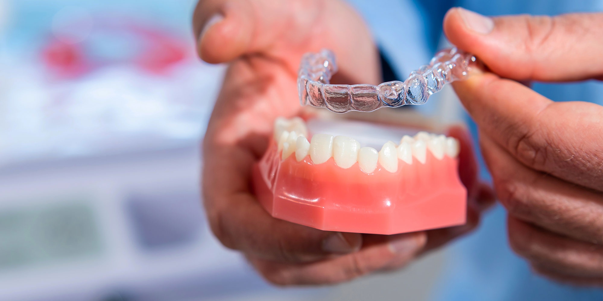 dentist showing patient invisalign