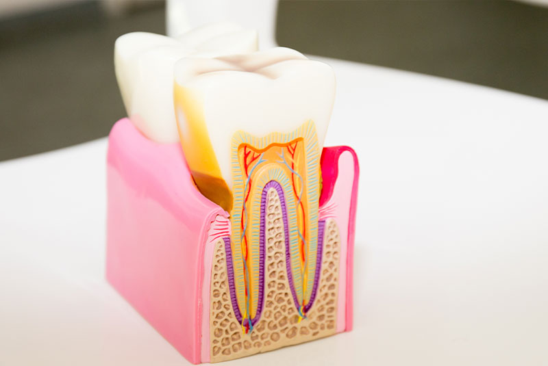 model of toth root