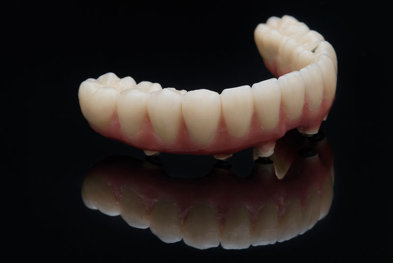 zirconia fixed bridge