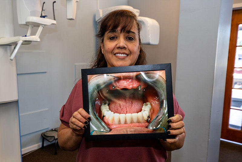 dental implant patient holding up photo of her mouth before the procedure