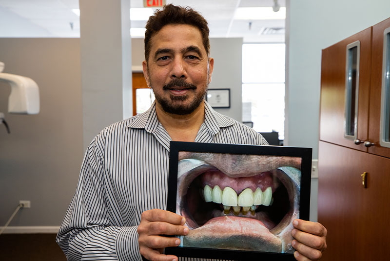Mohammed - dental implant patient smiling